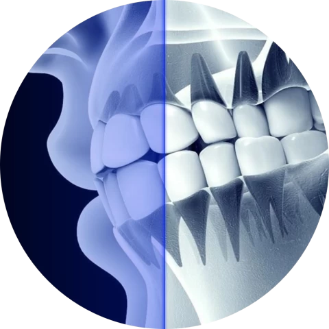 Баннер Диагностика зубов с помощью ИИ Баннер Диагностика зубов с помощью ИИ